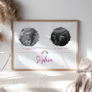 Ultraschallbild personalisiert zweifach mit Namen für Junge oder Mädchen - Geburtsposter, Schwangerschaft, Baby