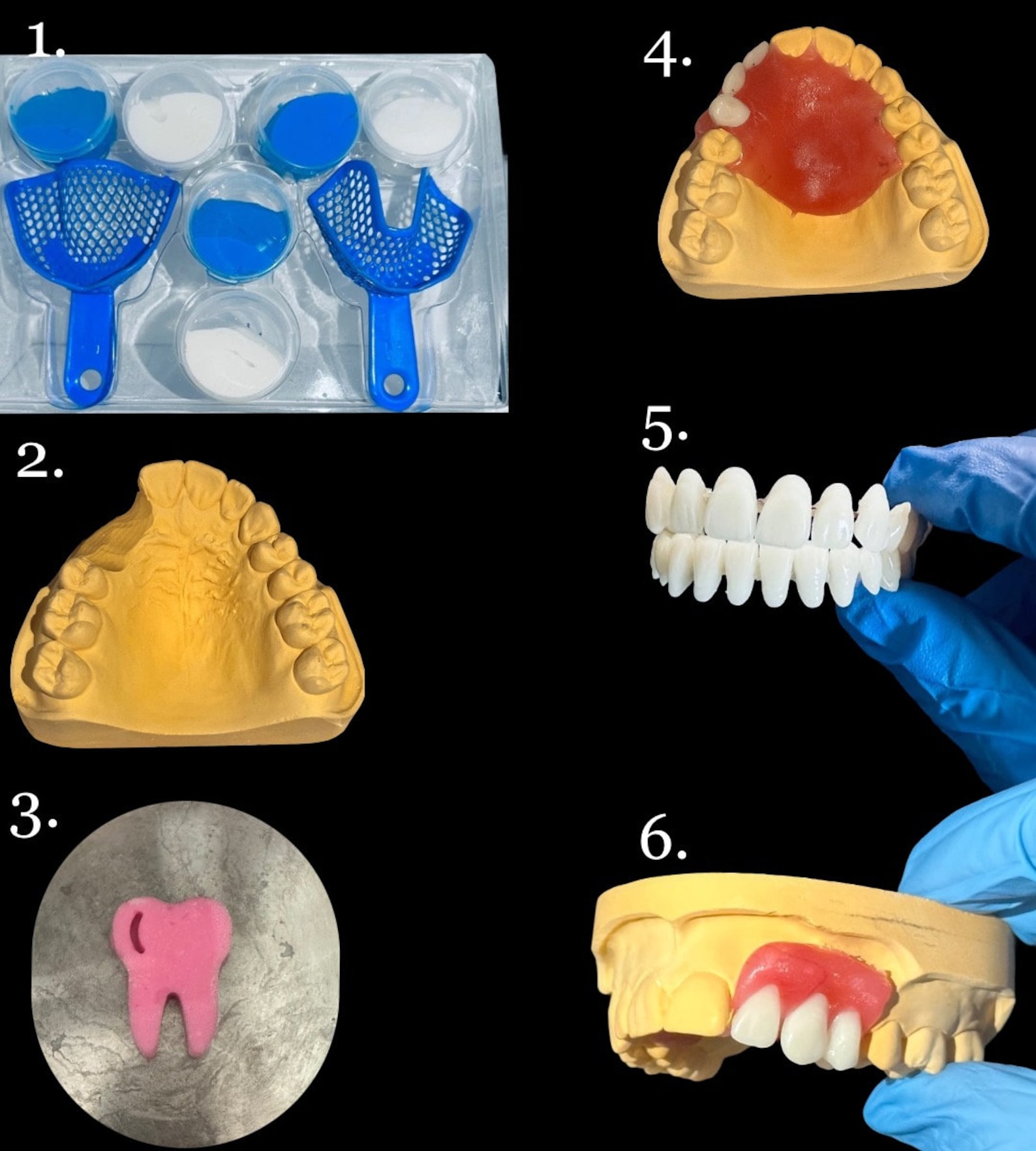 DIY Denture, Denture Kit, Dental Base, Improve Denture, Repair Kit Etsy