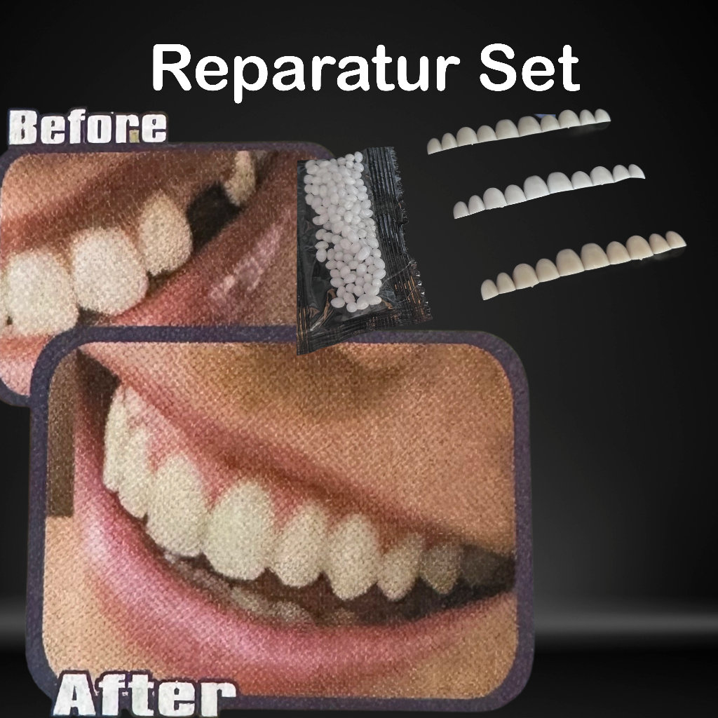 Chipped Tooth Filling Kit DIY Fix, Broken Teeth Emergency Repair Crafting  Kit, Composite Filling not a Medical Device 