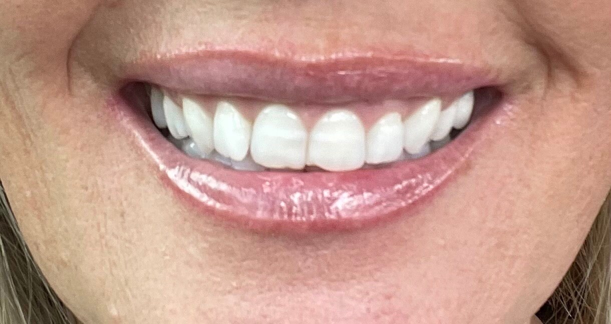 Natural Bentonite Clay/coconut Oil Remineralizing Toothpaste 4.5oz