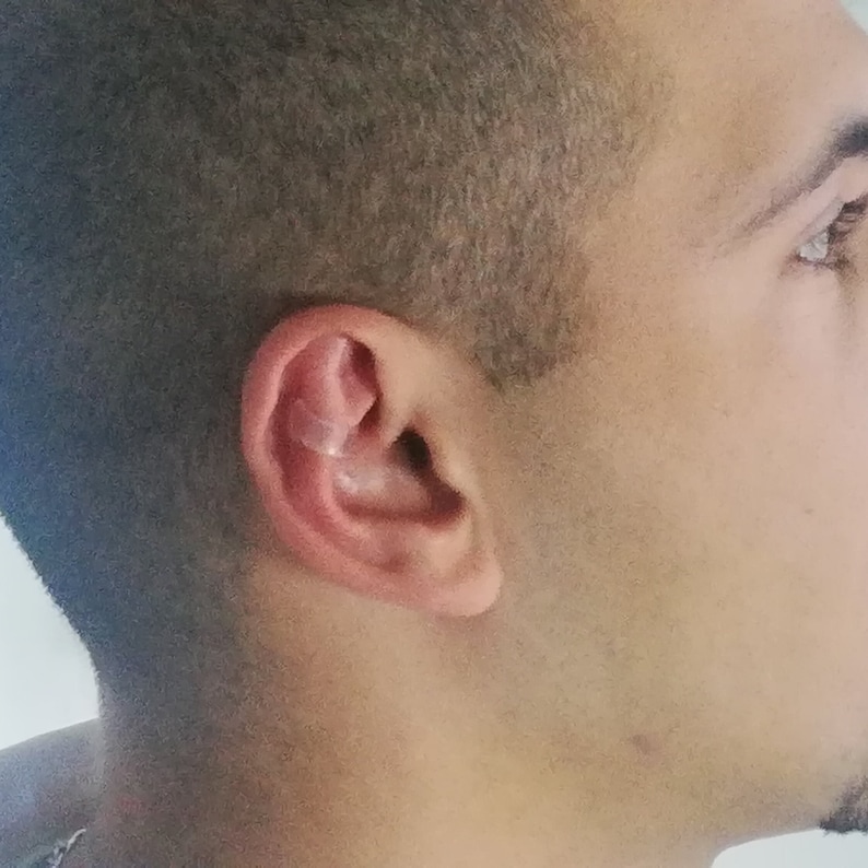 Corretores estéticos de orelhas de abano zdjęcie 6