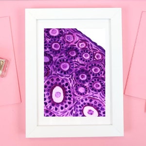 Ovary pathology print, histology art, medical art, gift for doctor