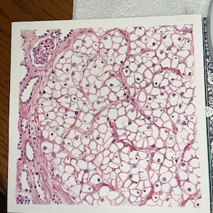 K&ouml;nnte beinhalten: Aquarellmalerei einer mikroskopischen Gewebeprobe, die ein Netzwerk von Zellen in Rosa- und Lilat&ouml;nen zeigt. Das Kunstwerk zeigt eine detaillierte biologische Struktur mit Fokus auf zellul&auml;re Muster und Texturen.