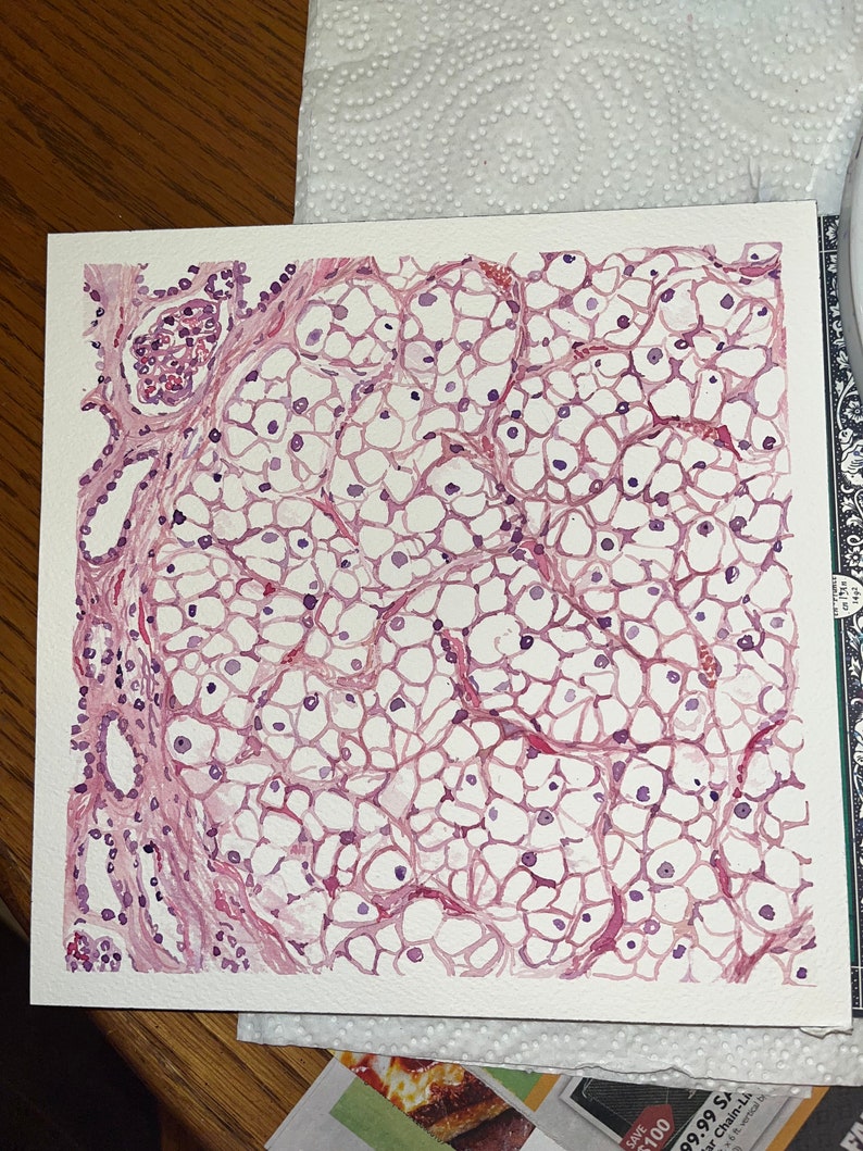 K&ouml;nnte beinhalten: Aquarellmalerei einer mikroskopischen Gewebeprobe, die ein Netzwerk von Zellen in Rosa- und Lilat&ouml;nen zeigt. Das Kunstwerk zeigt eine detaillierte biologische Struktur mit Fokus auf zellul&auml;re Muster und Texturen.