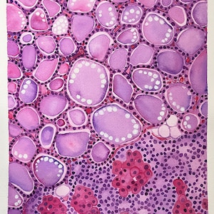 K&ouml;nnte beinhalten: Aquarellmalerei einer mikroskopischen Ansicht von Gewebezellen. Das Kunstwerk zeigt eine Vielzahl von Formen und Gr&ouml;&szlig;en in Rosa- und Lilat&ouml;nen, mit wei&szlig;en Punkten und dunkleren rosa Clustern. Der Gesamteffekt ist eine detaillierte und farbenfrohe Darstellung.