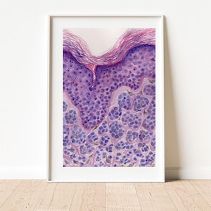 Puede incluir: Una impresión en acuarela enmarcada de un corte transversal de la piel. La obra de arte presenta una representación detallada de las capas de la piel en tonos morados y rosas, con estructuras celulares visibles. La impresión se muestra en un marco blanco.