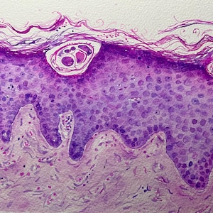 K&ouml;nnte beinhalten: Aquarellmalerei eines Hautquerschnitts, der Zellschichten in Lila- und Rosat&ouml;nen zeigt. Das Kunstwerk hebt zellul&auml;re Strukturen hervor, mit Fokus auf Epidermis und Dermis. Das Bild hat ein wissenschaftliches oder medizinisches Thema.