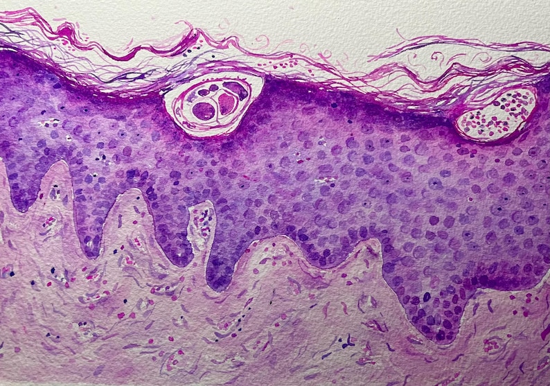 K&ouml;nnte beinhalten: Aquarellmalerei eines Hautquerschnitts, der Zellschichten in Lila- und Rosat&ouml;nen zeigt. Das Kunstwerk hebt zellul&auml;re Strukturen hervor, mit Fokus auf Epidermis und Dermis. Das Bild hat ein wissenschaftliches oder medizinisches Thema.