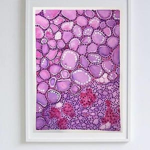 Custom Pathology Watercolor Painting | Personalized Medical Art Gift