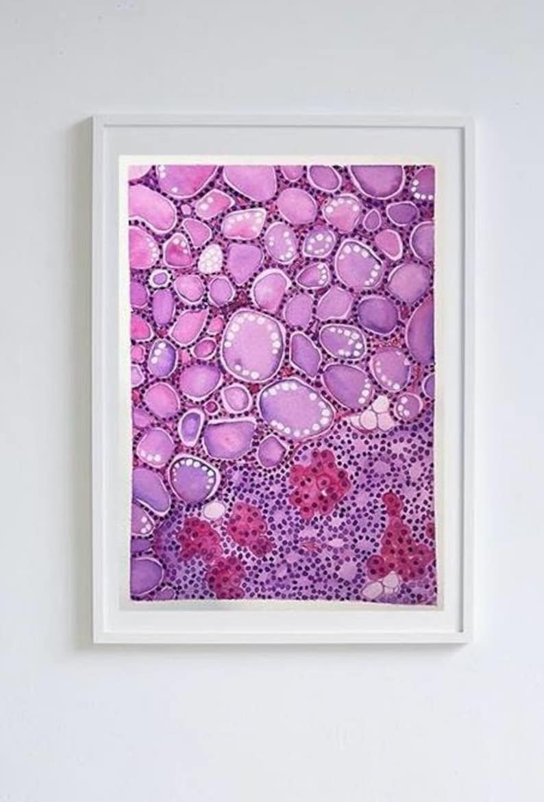 Individuelle Aquarellmalerei zum Thema Pathologie | Personalisiertes Geschenk aus der Medizinkunst Bild 1