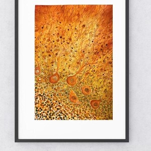 Neuron Histology – Vibrant Pathology Watercolor Artwork with Gold Accents, 9x12