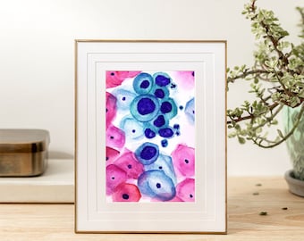 Original Pathology Painting – High-Grade Pap Smear, Watercolor 8x6”