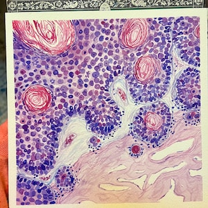 K&ouml;nnte beinhalten: Aquarellmalerei einer mikroskopischen Gewebeprobe. Das Kunstwerk zeigt eine Mischung aus lila, rosa und wei&szlig;en Farbt&ouml;nen mit kreisf&ouml;rmigen und unregelm&auml;&szlig;igen Formen. Das Gem&auml;lde hat ein wissenschaftliches oder medizinisches Thema.