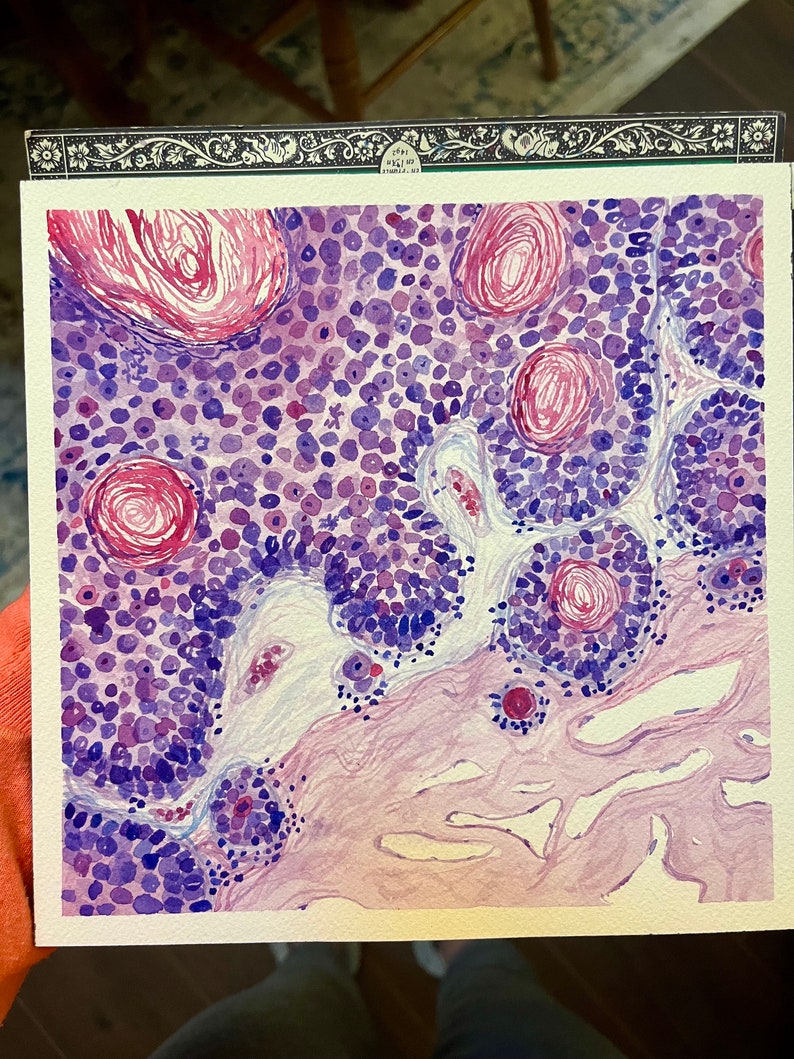 K&ouml;nnte beinhalten: Aquarellmalerei einer mikroskopischen Gewebeprobe. Das Kunstwerk zeigt eine Mischung aus lila, rosa und wei&szlig;en Farbt&ouml;nen mit kreisf&ouml;rmigen und unregelm&auml;&szlig;igen Formen. Das Gem&auml;lde hat ein wissenschaftliches oder medizinisches Thema.