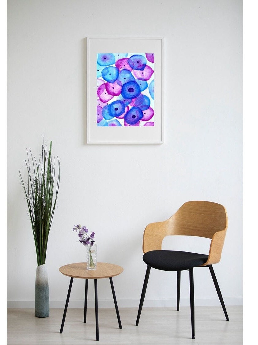 Pathology Art Print: Koilocytes, PAP smear, LSIL