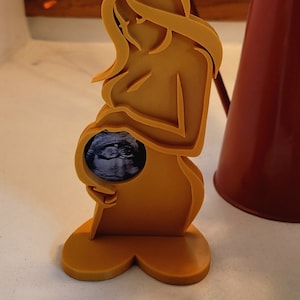 Ultrasound Display Figure