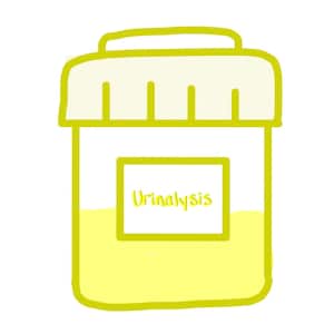Puede incluir: Un recipiente de plástico amarillo con tapa y la palabra "Urinalysis" impresa en una etiqueta. El recipiente está lleno de un líquido amarillo.