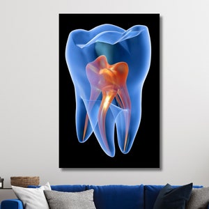 X-ray Molar Tooth Canvas, Dental Art, Dentist Art, Dental Clinic Decor Canvas Wall Art,Abstract Teeth Canvas Wall Art, Gift for the Dentist