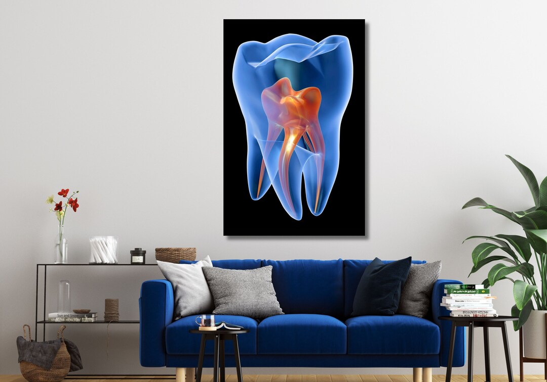 X-ray Molar Tooth Canvas, Dental Art, Dentist Art, Dental Clinic Decor ...