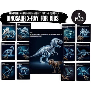 May include: A set of 16 printable dinosaur x-ray images for children. The images feature different dinosaurs, including a T-Rex, Triceratops, and Stegosaurus. Each image includes a description of the dinosaur and its features.
