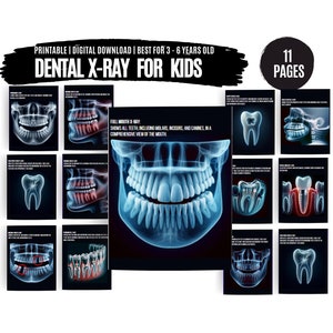 Printable Dental X-Rays for kids. Pretend play kids X-Ray activity for dentist role play. Print at home dentist play kit. Realistic X-Ray