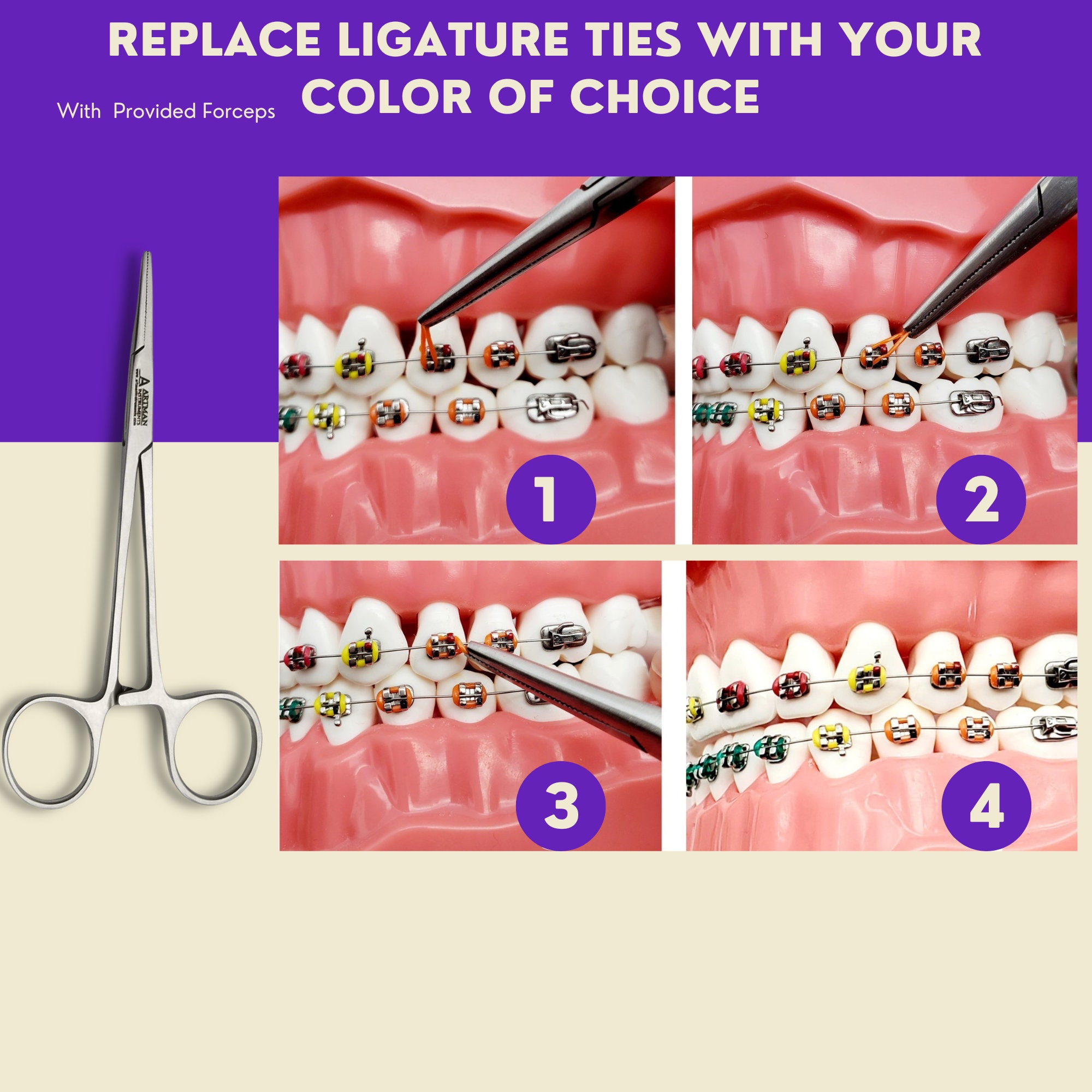 Braces Color Changing Kit, Ties Changing Kit Etsy