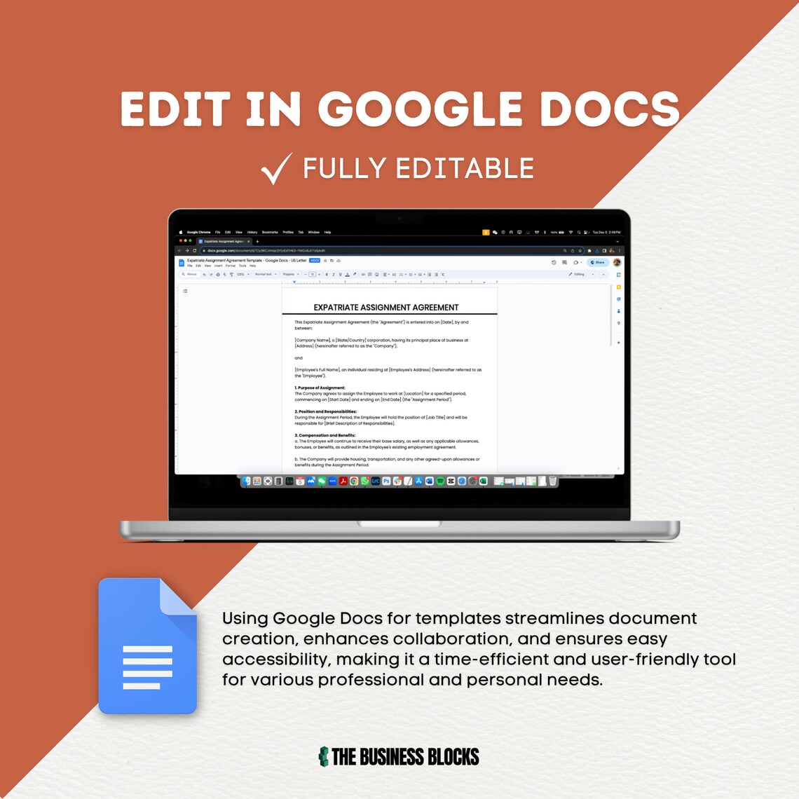 Expatriate Assignment Agreement Template: Global Relocation Contract ...