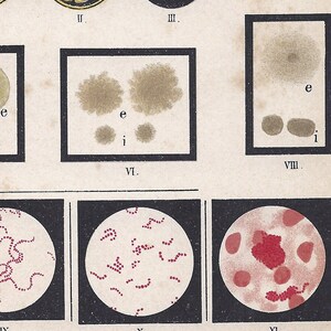 May include: A scientific illustration showing different stages of bacterial growth in test tubes and petri dishes. The image includes text labels for each stage, such as "I", "II", "III", "IV", "V", "VI", "VII", "VIII", "IX", "X", and "XI".