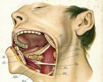 Temporary jaw resection | 1909 Colored Antique Medical Print - Detailed Illustrations of Temporary resection of the mandible (Langenbeck)