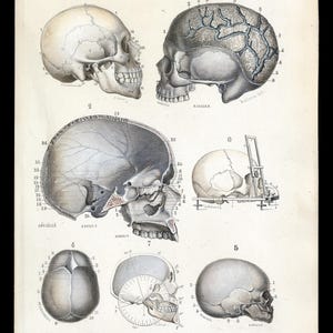 May include: A detailed anatomical illustration of a human skull, showing various views and sections. The skull is labeled with numbers and anatomical terms. The image is from an old medical textbook and is in black and white with some hand-coloring.