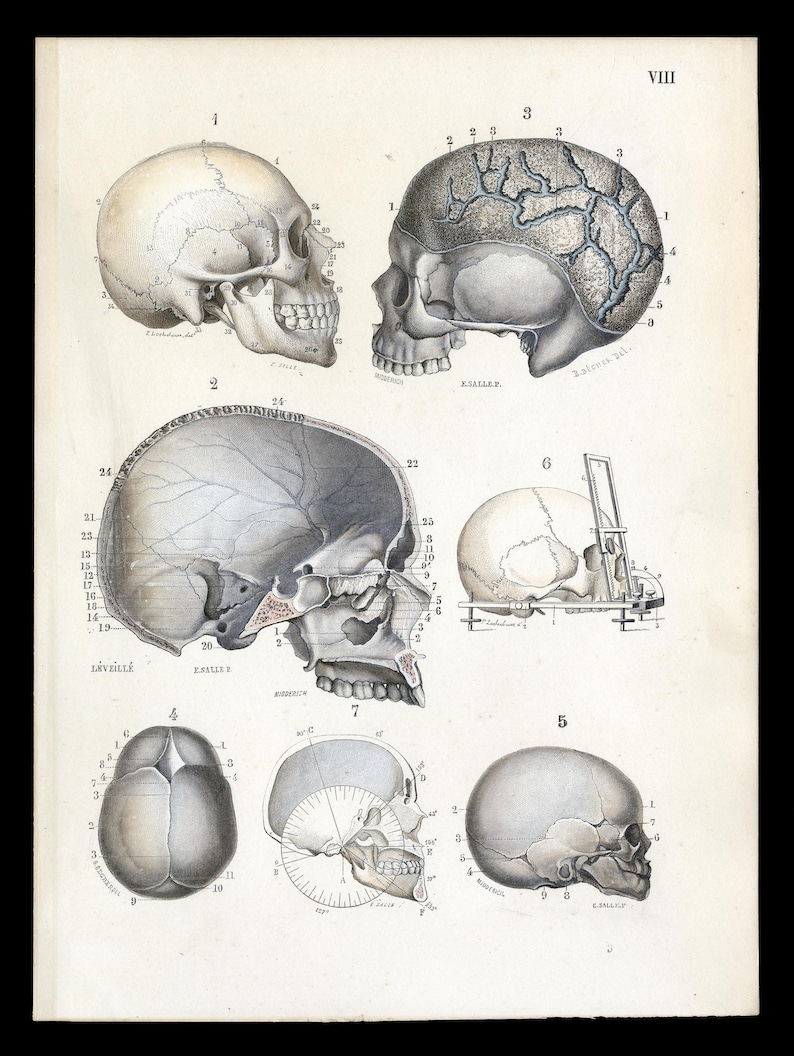 May include: A detailed anatomical illustration of a human skull, showing various views and sections. The skull is labeled with numbers and anatomical terms. The image is from an old medical textbook and is in black and white with some hand-coloring.