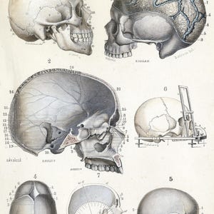 May include: A detailed anatomical illustration of a human skull, showing various sections and features. The skull is depicted in multiple views, including side, top, and bottom perspectives. The illustration is labeled with numbers and text, indicating different bones and structures.