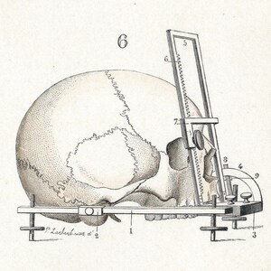 May include: A black and white illustration of a human skull being measured with a tool. The skull is held in place by a metal frame with a screw. The tool has a ruler and a protractor. The numbers 1 through 9 are labeled on the tool. The text "P. Lackebuch. war d." is visible on the frame.