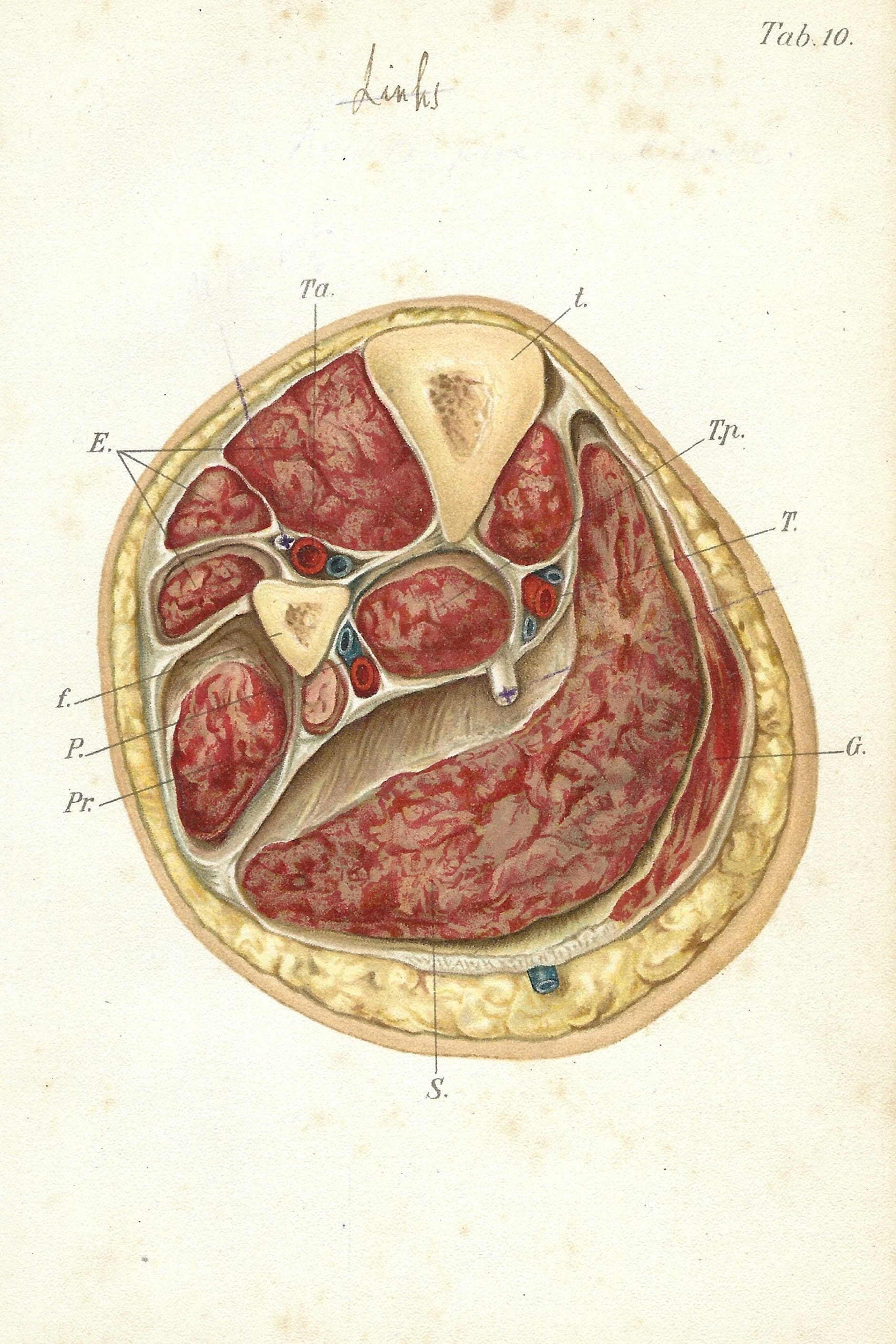 アンティーク解剖学プリント - 人間の四肢の断面図 | 1909年 手彩色
