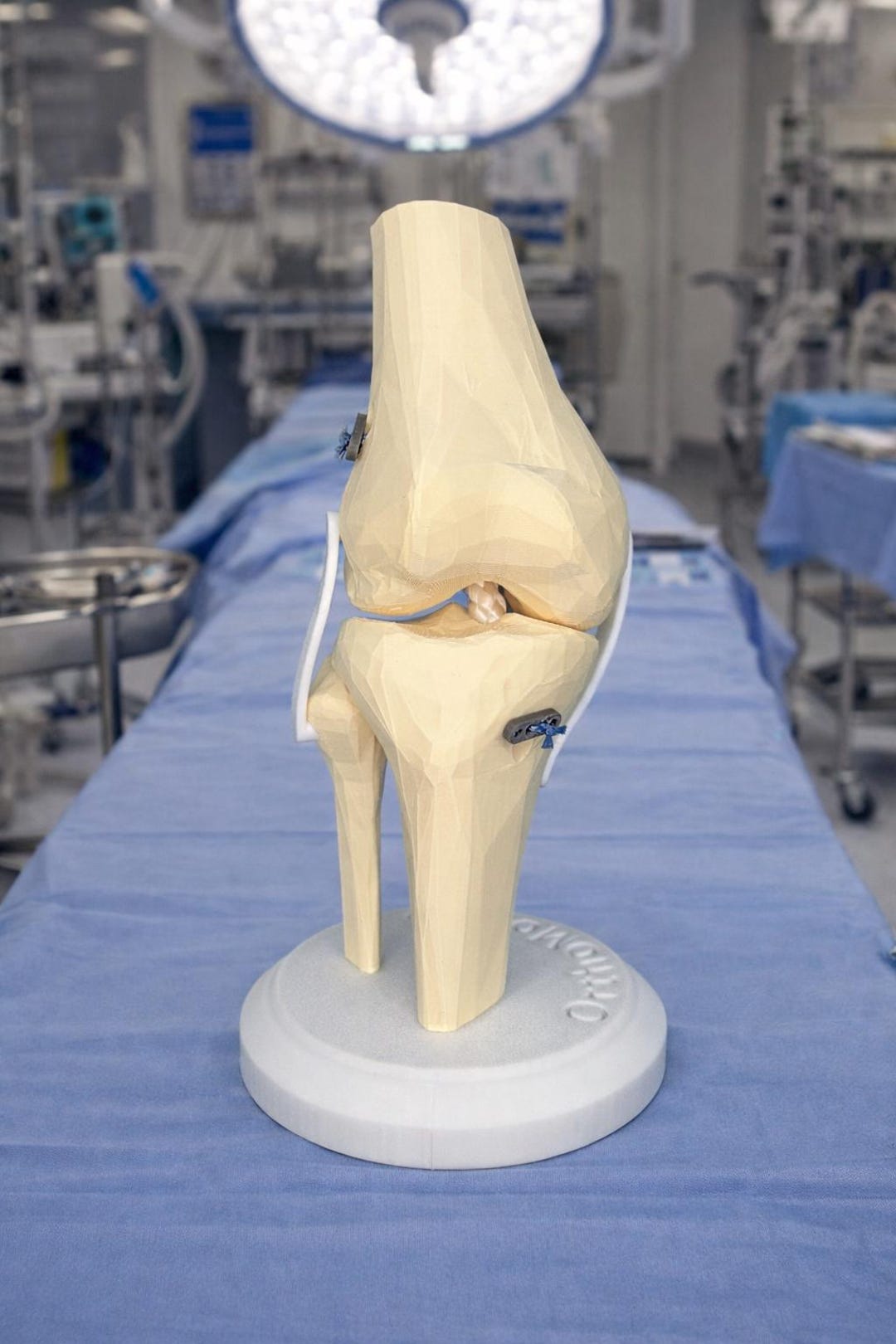 3D Printed ACL Repair Model - Etsy