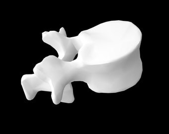 3D Printed Lumbar Spine Vertebrae