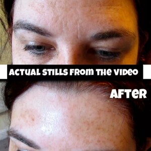 BOTOX ALTERNATIVE Miracle One 1 minute Instant Facelift wrinkle remover eye bag dark circle face cream serum filler better than moisturiser image 3