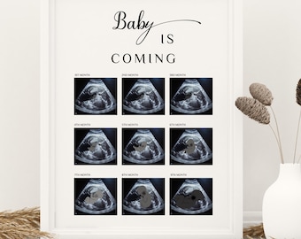 Ultraljud för bebis, Sonogram för bebis: Fotokollage om livmoderutveckling (Canva-mall)