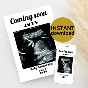 Bewerkbare foto babyaankondigingskaart Aanpasbare baby onderweg sjabloon afdrukbare echografie DIGITALE DOWNLOAD MB4