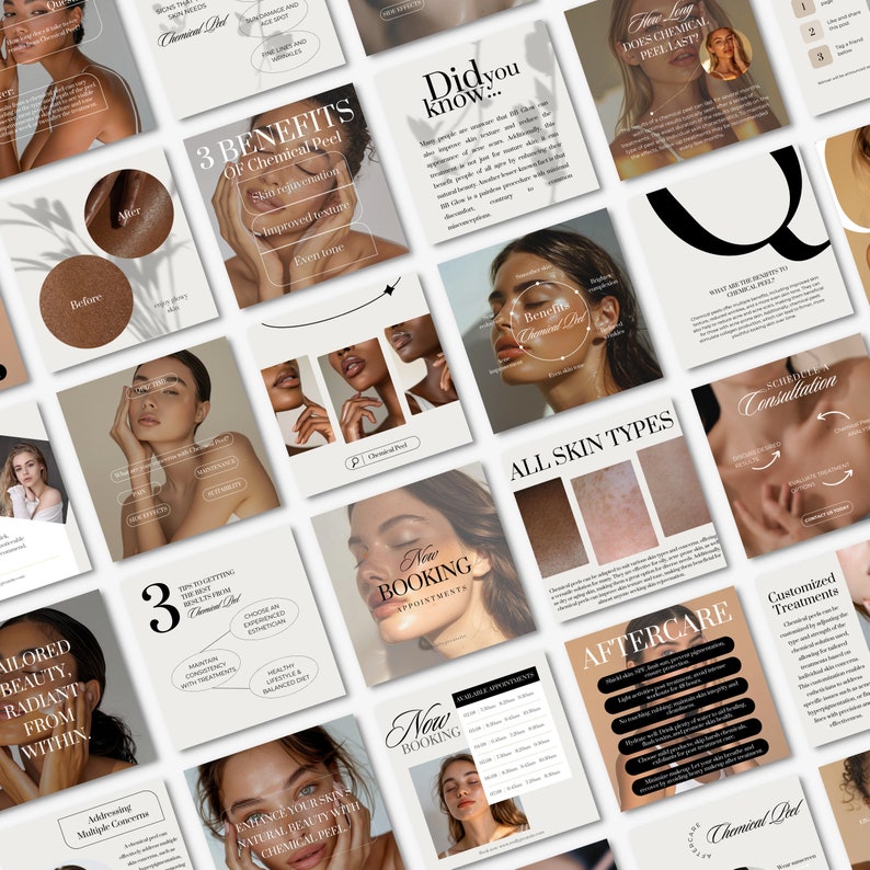 Facial Posts and Instagram Stories, Neutral Canva Templates for Estheticians image 6