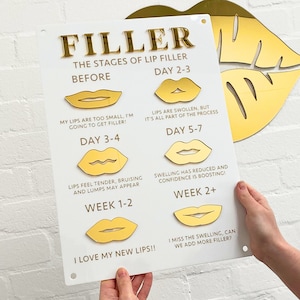 Lipvuller Journey 3D acryl bord | Esthetiek Displayborden | Beauty Clinic wanddecoratie | Informatiebord salon | A3-formaat