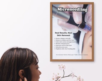 Microneedling Benefits Poster | Clinical Esthetician Wall Art | Professional Treatment Room Consultation Tool