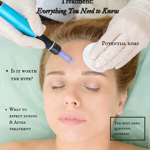 The Insider’s Guide to Dermapen Treatment: Everything You Need to Know- microneedlings- what results to expect from microneedling
