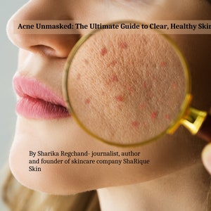 Acne Unmasked: The Ultimate Guide to Clear, Healthy Skin| How to get rid of pimples, acne, blackheads| Acne Cure| Acne Solution