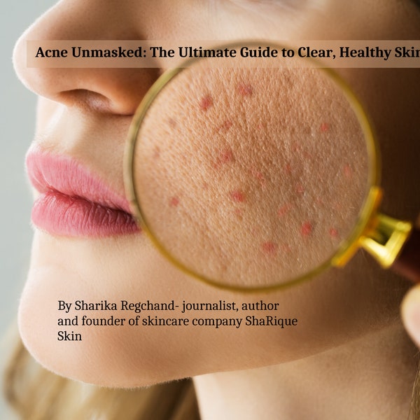 Acne Unmasked: The Ultimate Guide to Clear, Healthy Skin| How to get rid of pimples, acne, blackheads| Acne Cure| Acne Solution