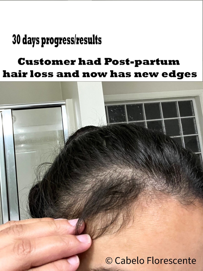 Hair Growth Oil and Scalp Treatment for Maximum Growth DHT Blocker