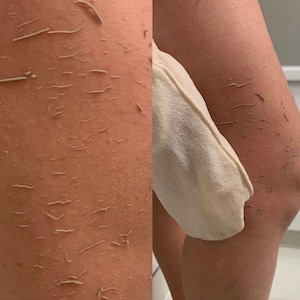 May include: Close-up of a person's leg before and after using an exfoliating scrub. The left side of the image shows dry, flaky skin with visible lines. The right side shows smoother skin after using the scrub.