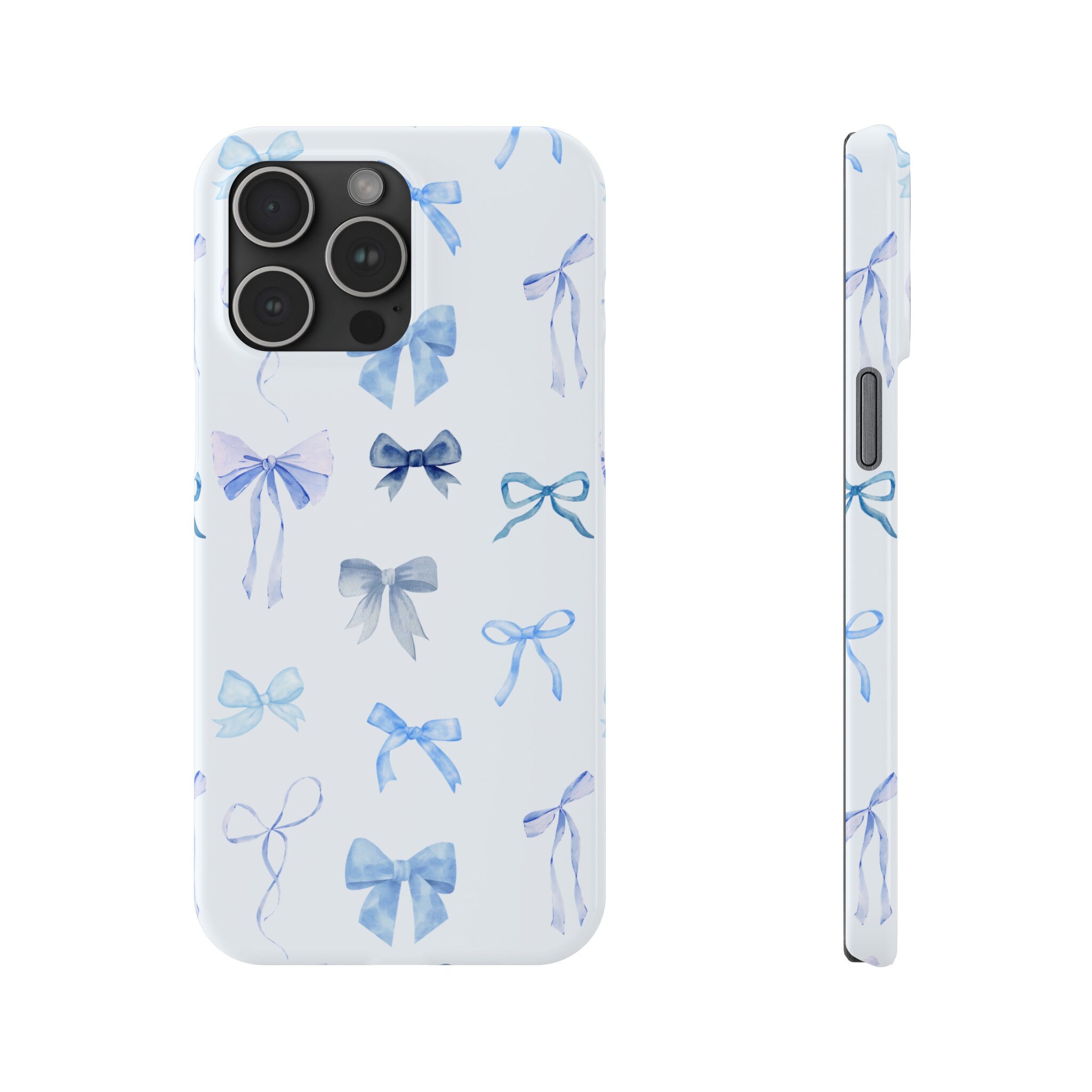 Blue Coquette Aesthetic Phone Cases, Cute Blue Coquette Phone Cases, Cottagecore iPhone Cases, Blue Balletcore, Trendy Bow Phone Cases
