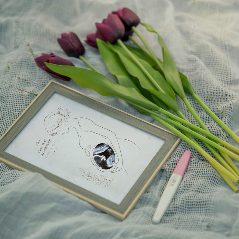 Editable Ultrasound Keepsake Template | Pregnancy Announcement Gift ...
