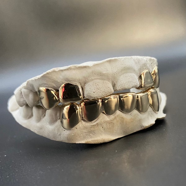Gold Grillz Etsy